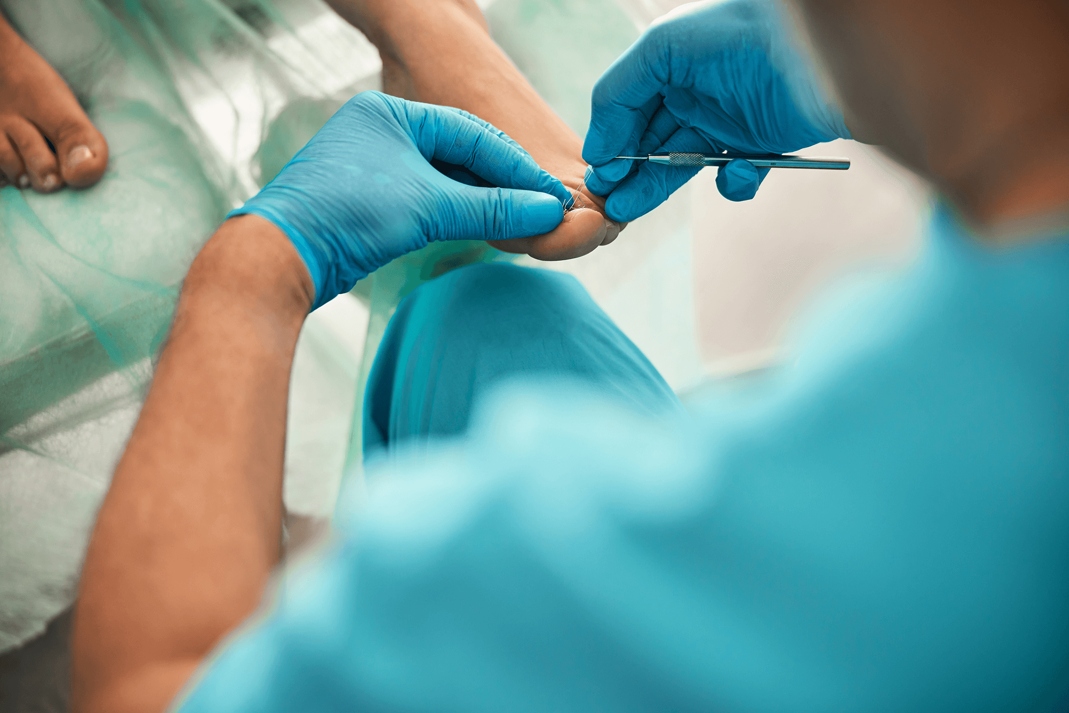 Close up of professional podiatrist wearing uniform while treating ingrown toenail