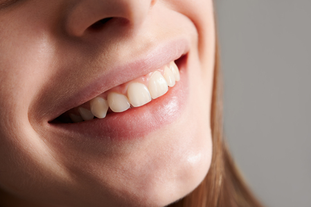 Close up of smiling female face with healthy straight white teeth. Joyful young woman demonstrating perfect toothy smile. Concept of dentistry, stomatology and dental care.