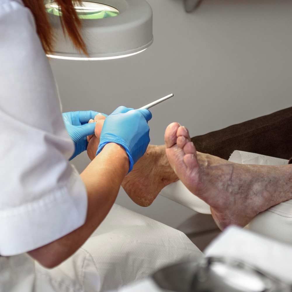 Close-up of professional doing medical pedicure on old feet. Woman wearing blue gloves, holding tool for medical pedicure, treating feet and toes of a senior client. How podiatrist remove corns.