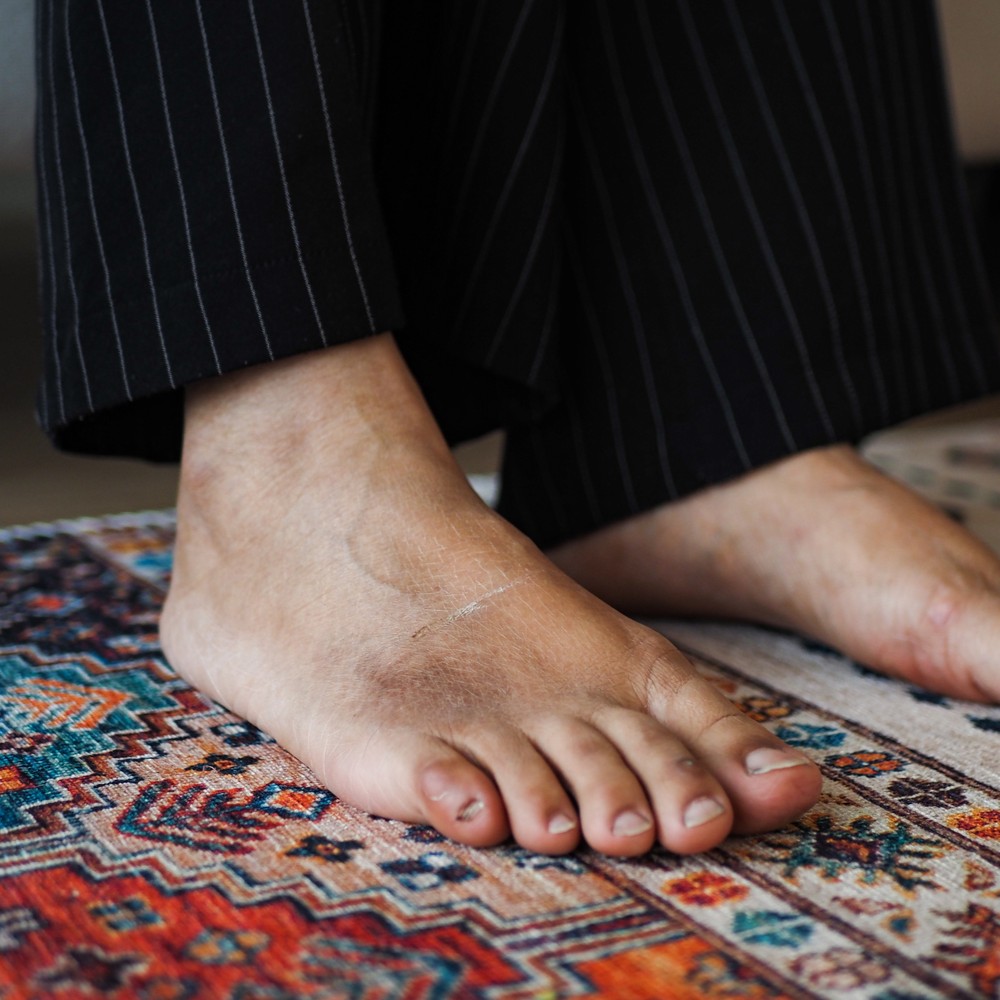 What Causes Flat Foot? Understanding the Condition and Its Root Causes