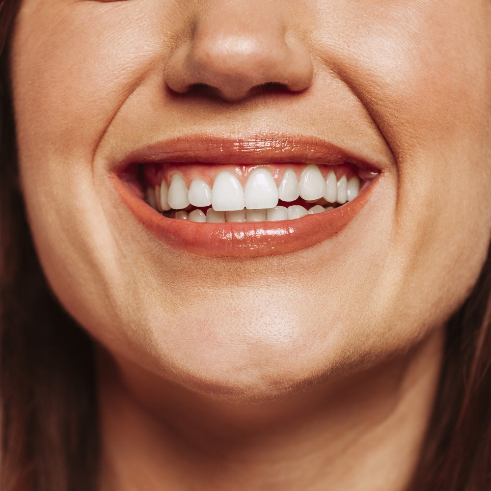 How to Maintain Healthy Teeth After the Festivities