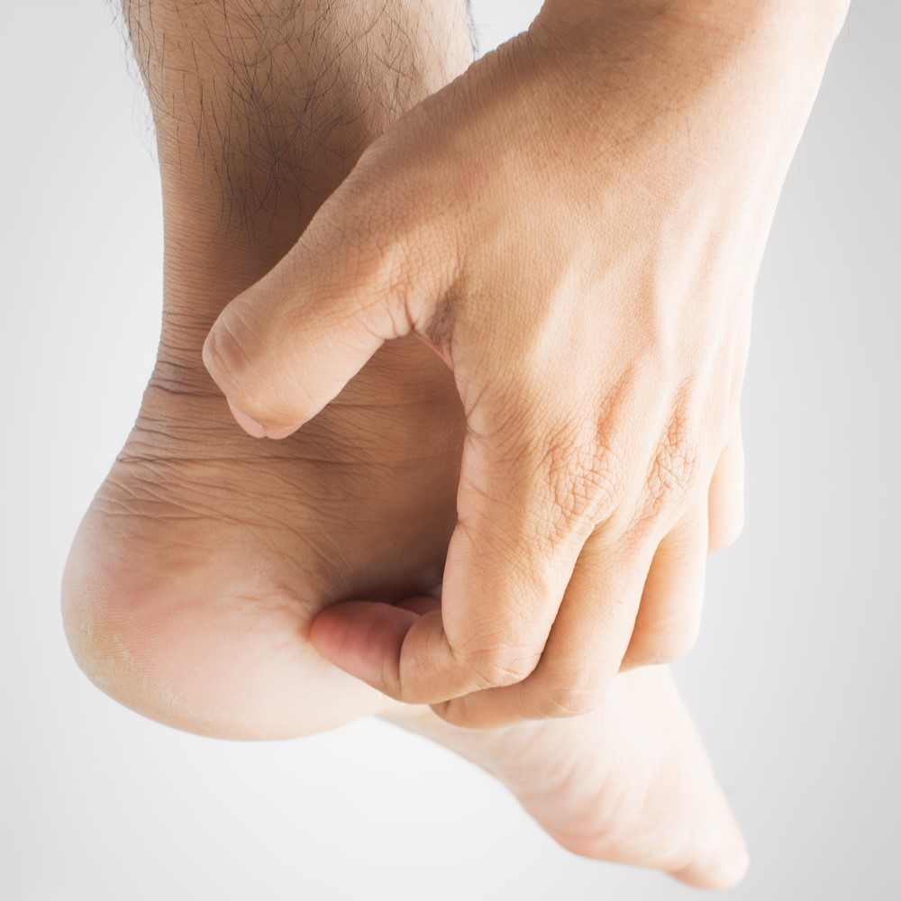 Are you dealing with Foot Eczema?