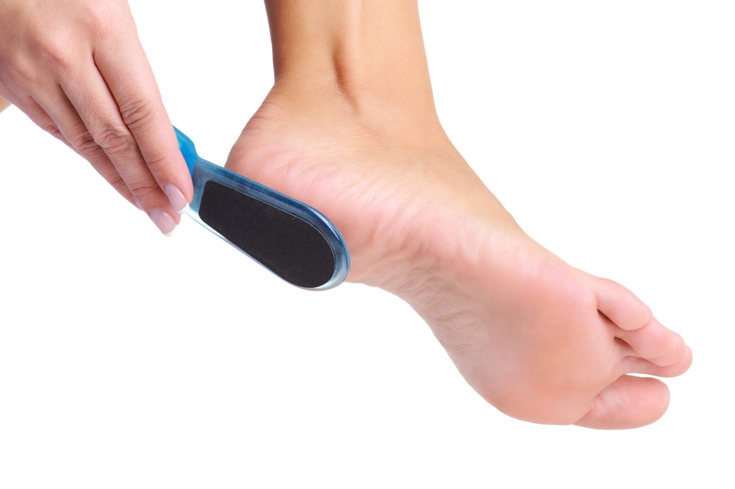 9 Tips to treat dry and cracked heels